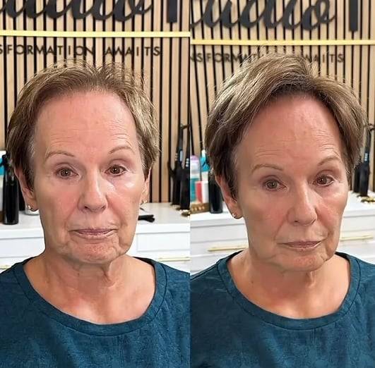 Invisible Volume Boost Hair Topper for Thinning Crowns