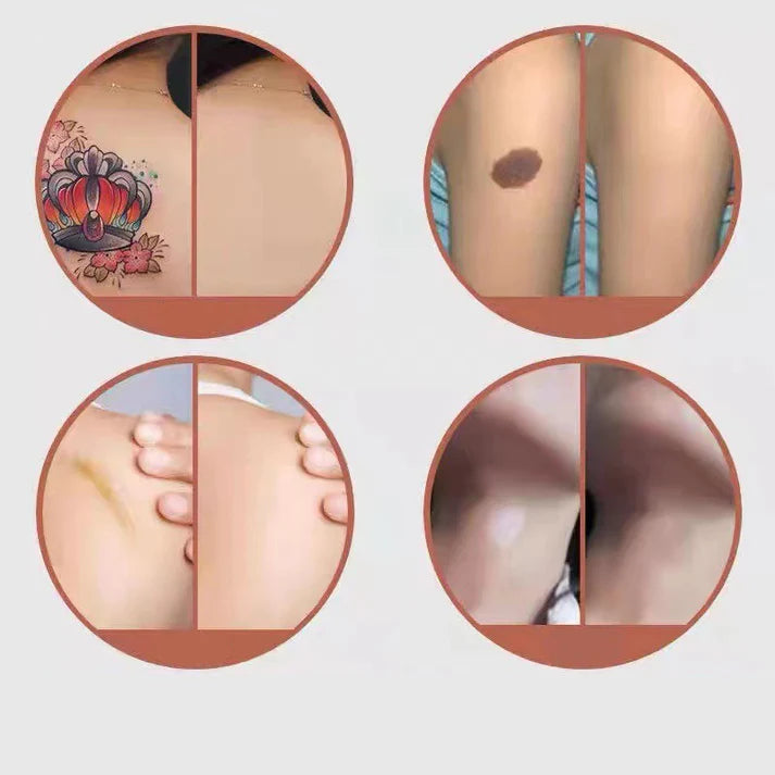 HealEase – Advanced Scar Cover Patch
