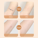 HealEase – Advanced Scar Cover Patch