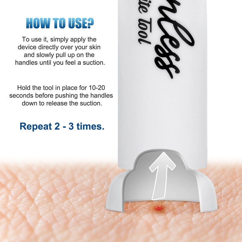 ItchAway – Instant Bite & Sting Relief Tool