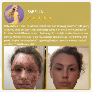 BeeVenom – Advanced Skin Restoration Cream