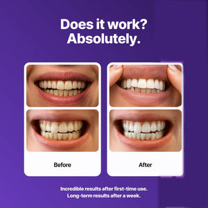 BrightViolet - Purple Teeth Whitening Strips