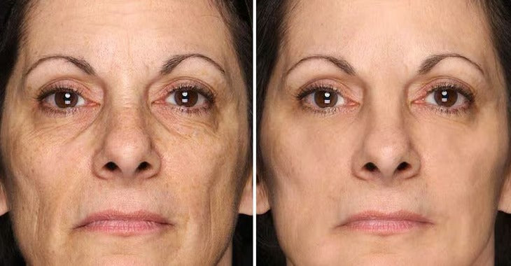 PowerRedo – Instant Wrinkle Repair Serum