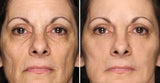PowerRedo – Instant Wrinkle Repair Serum