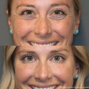 Brightify - Undereye Color Corrector for Instant Radiance