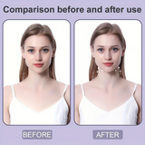FacioFix – Professional Tape for Instant Facial Tightening