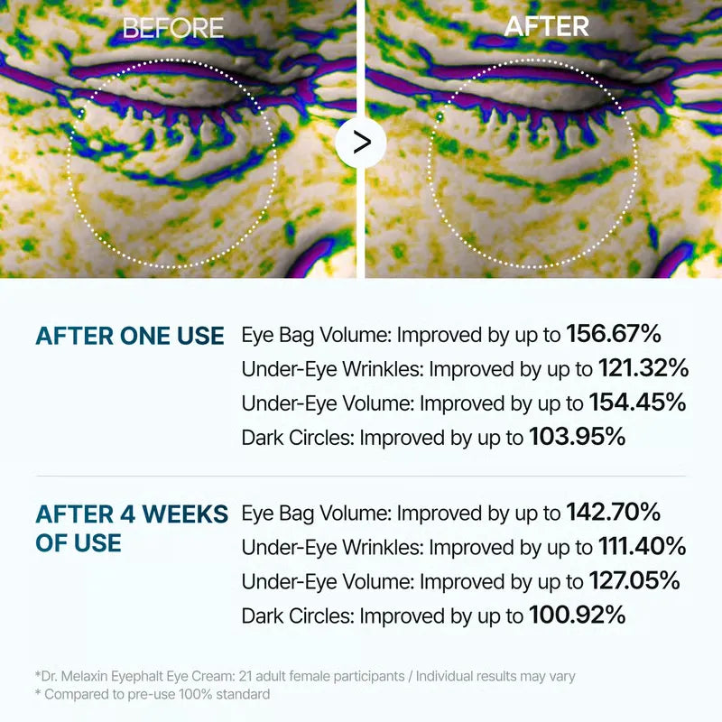 EyephaltPro – Clinical Eye Bag Corrector