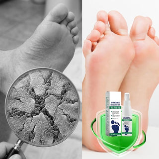 PureStep – Cooling Foot Relief Spray