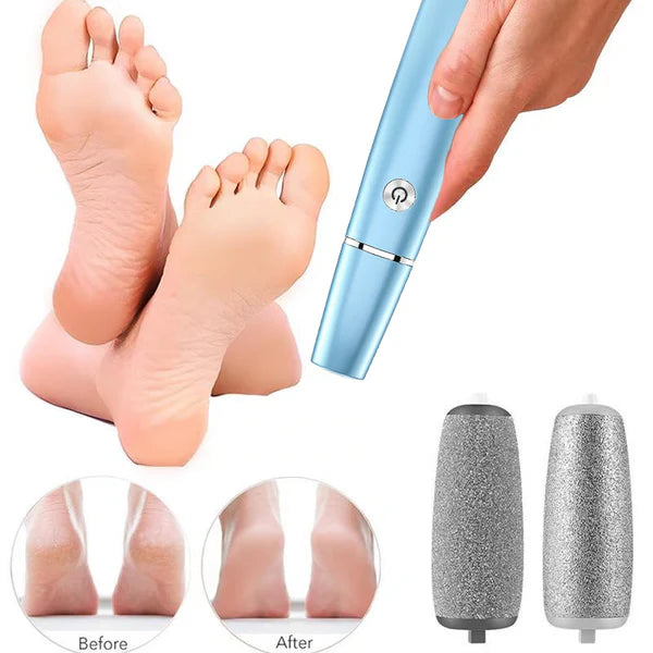SoleSmooth - Electric Foot Callus Remover