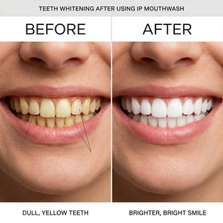 😁 Teeth whitening, gum swelling and pain relief, gum repair, halitosis treatment, mouthwash for removing foreign objects, whitening mouthwash