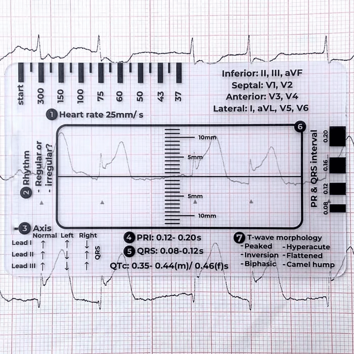 MediTrack – Professional ECG Assessment Pocket Guide