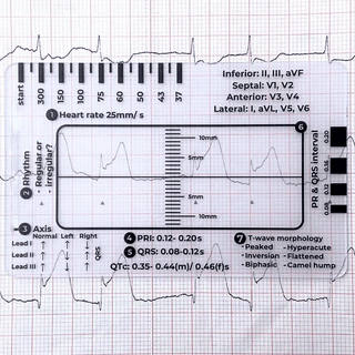 MediTrack – Professional ECG Assessment Pocket Guide