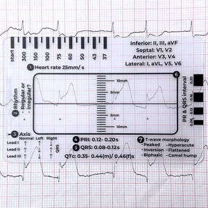 MediTrack – Professional ECG Assessment Pocket Guide