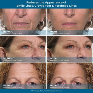 DermaLift – Skin Tightening Serum