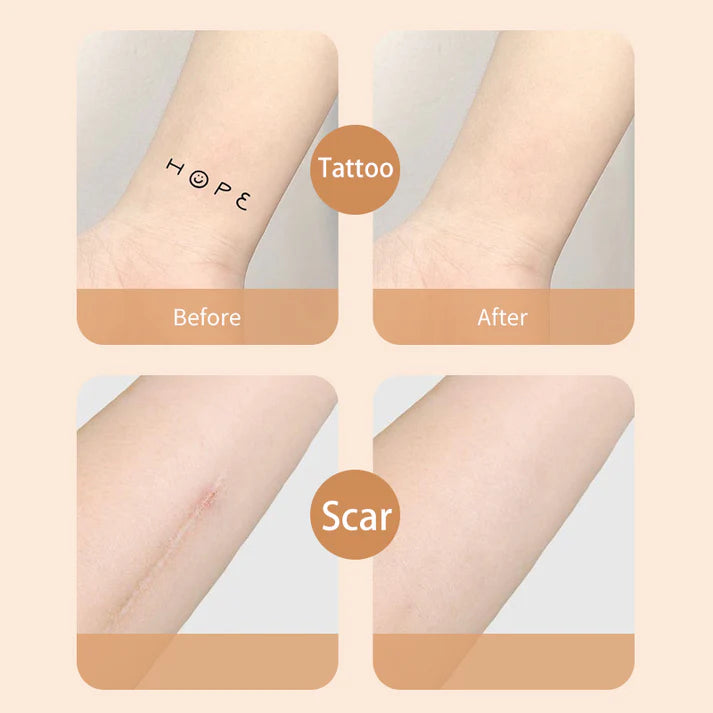 HealEase – Advanced Scar Cover Patch