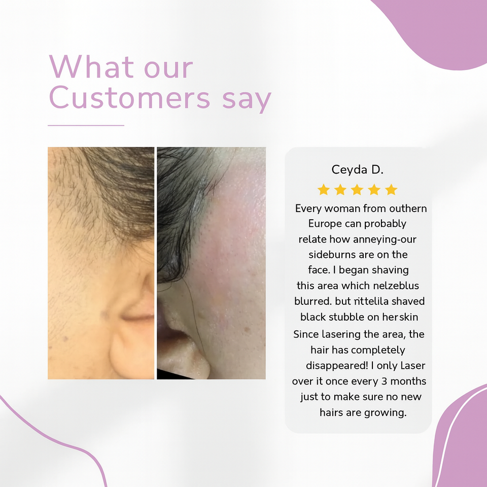 LumaGlow-IPL Hair Removal Device