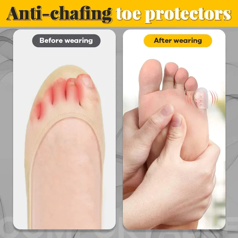 ToeEase – Soft Silicone Anti-Friction Toe Protector