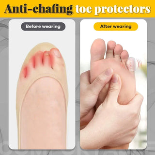 ToeEase – Soft Silicone Anti-Friction Toe Protector