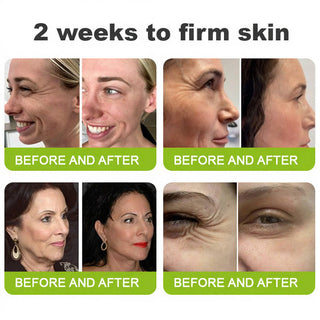 SkinRevive – Advanced Peptide Retinol Firming Serum