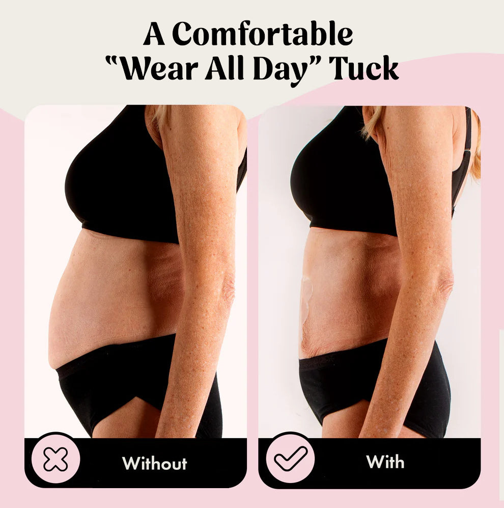 DermaBond – Skin Tape for Sensitive Skin