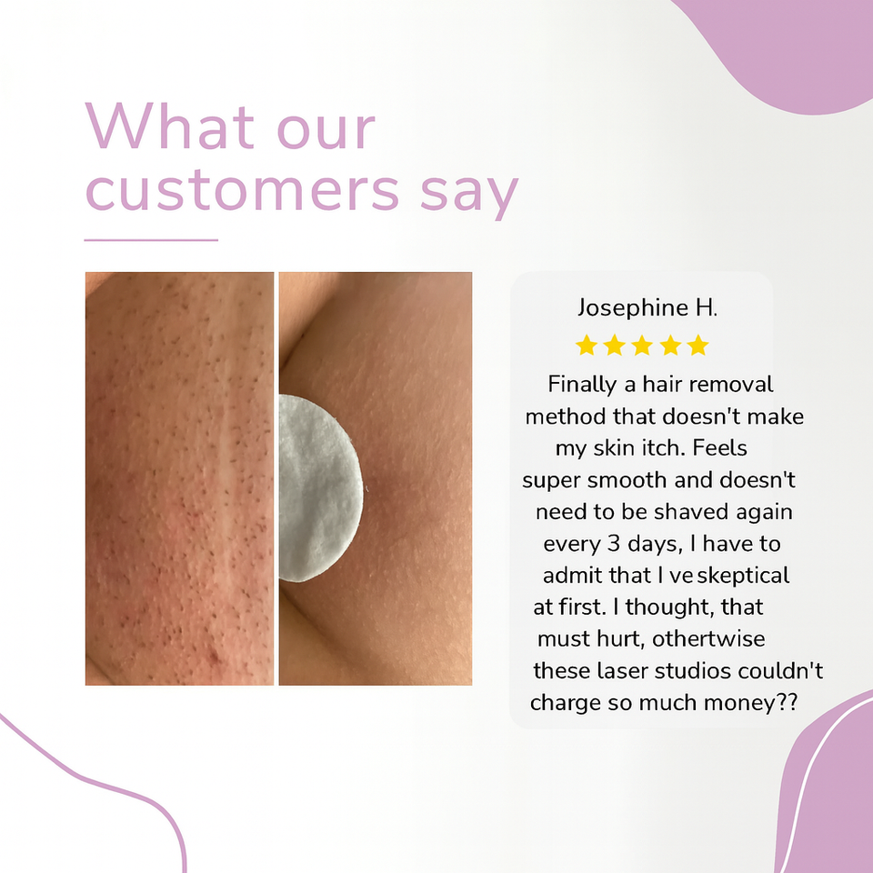 LumaGlow-IPL Hair Removal Device