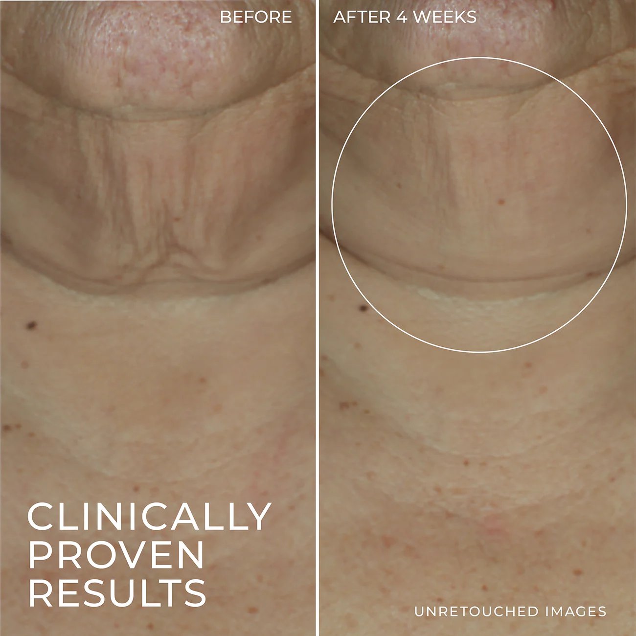 GlowCore – Wrinkle Repair Serum Stick