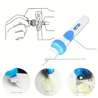 SilkEar - Ultra-Gentle Earwax Extraction Tool