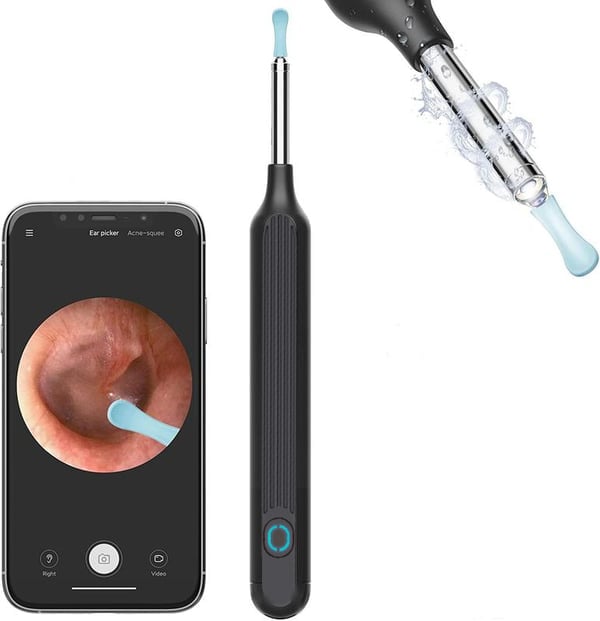 ClearEar - 1080P Ear Wax Camera for Precise Cleaning