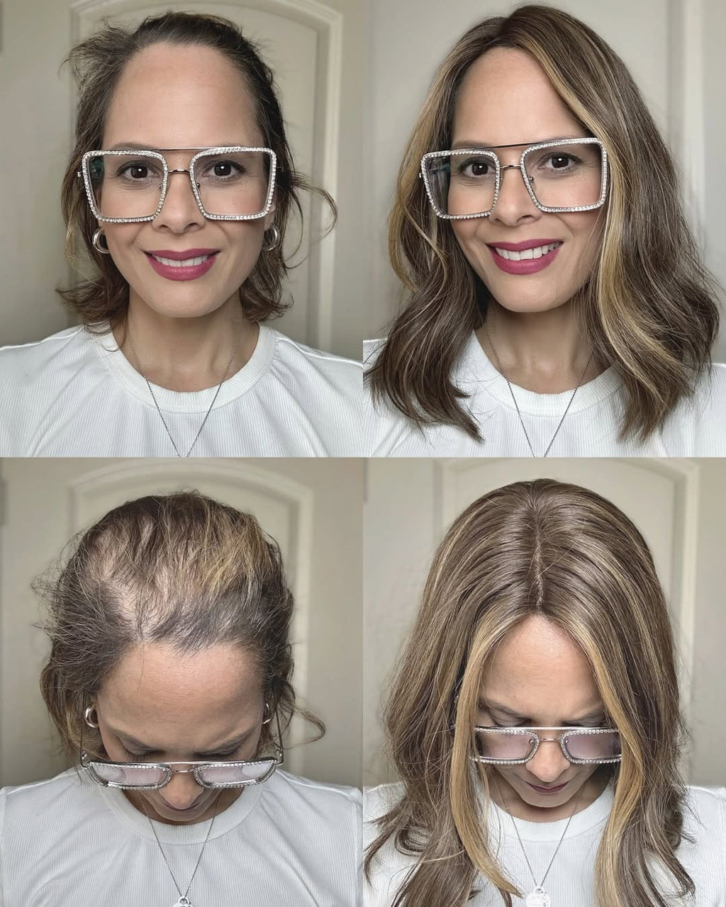 BionicGlow - Ultra-Thin Comfortable Hair Wig