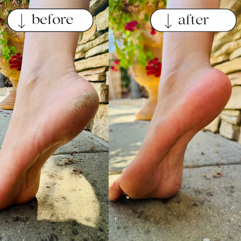 PediPro - Ultimate Callus Remover Foot File