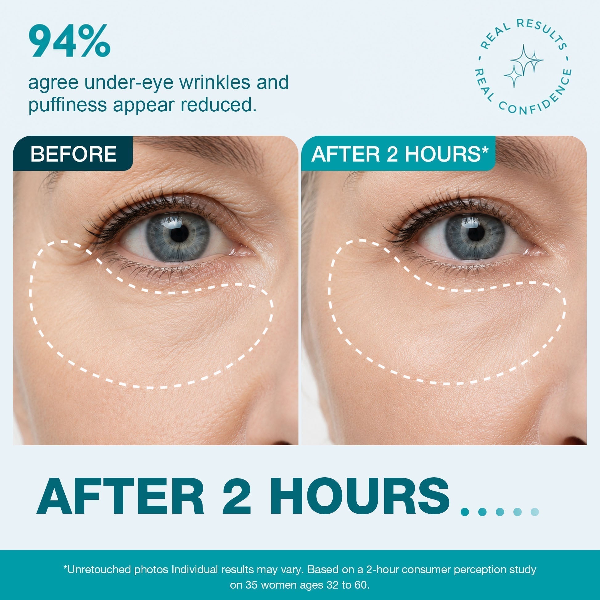 SmoothLuxe – Peptide Powered Facial Smoothing Tape