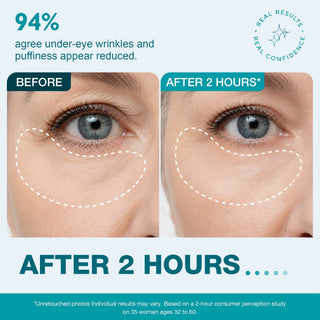 SmoothLuxe – Peptide Powered Facial Smoothing Tape