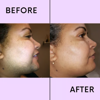 SmoothEase – Gentle Facial Hair Removal Device