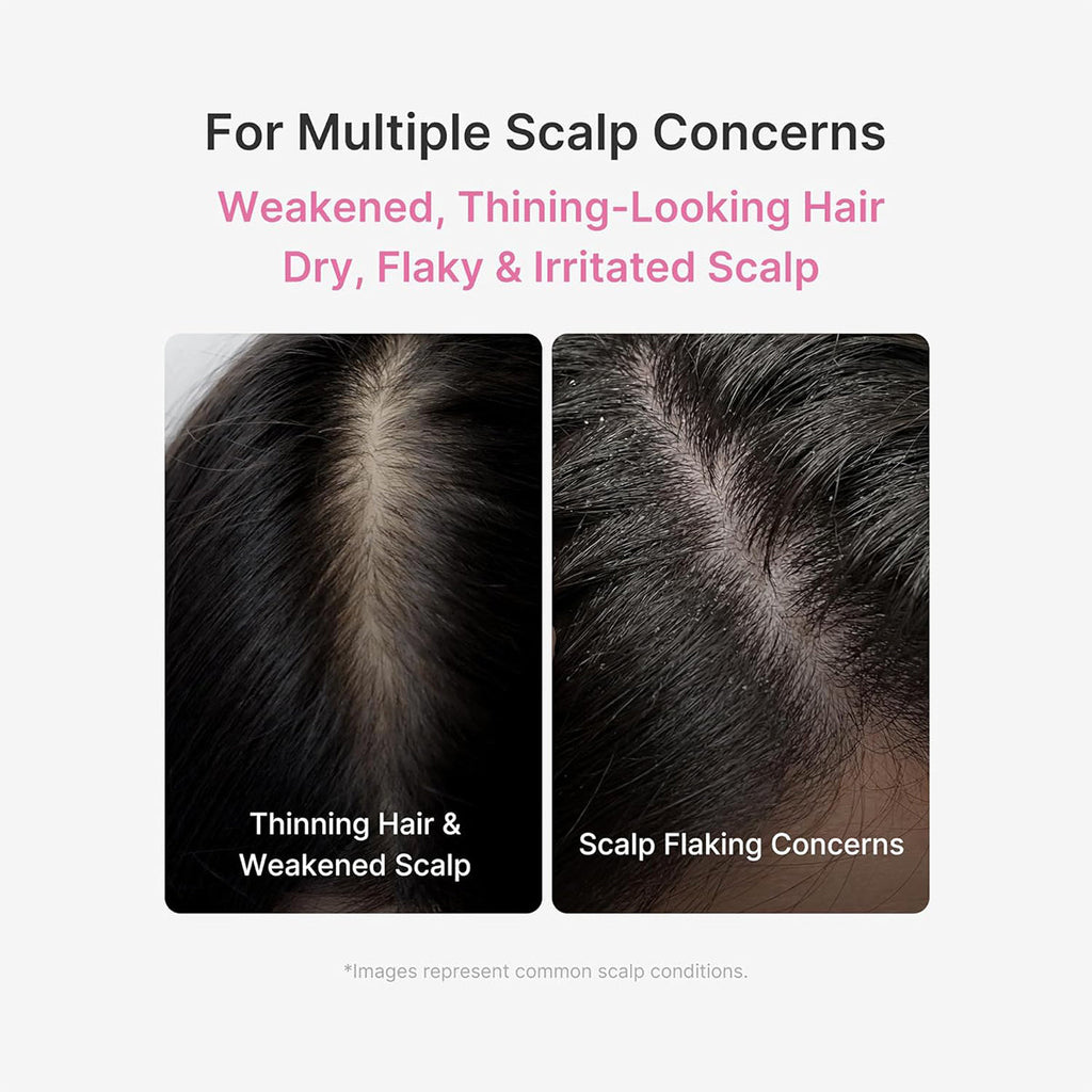 ScalpRevive – PDRN Spicule Root Care Treatment
