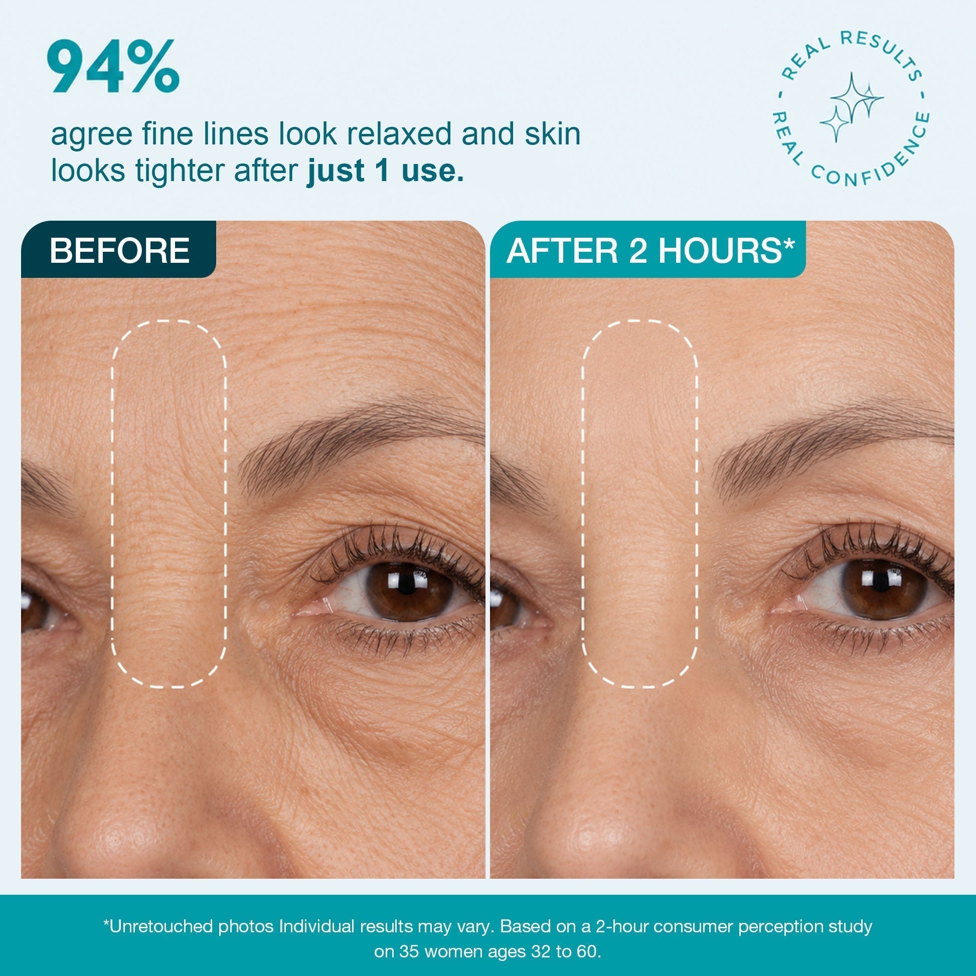 SmoothLuxe – Peptide Powered Facial Smoothing Tape