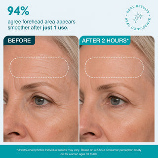 SmoothLuxe – Peptide Powered Facial Smoothing Tape