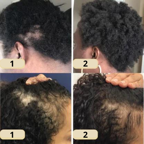 Nature’s Tress – Hair Revitalizing Oil