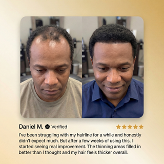 RootRevive – Advanced Batana Oil Hair Regrowth Therapy