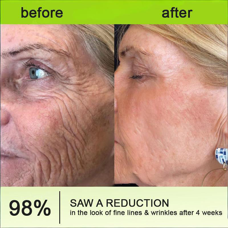 SkinRevive – Advanced Peptide Retinol Firming Serum