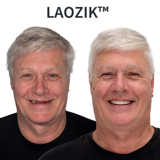 DentalKit - Natural Look and Feel Without the Dentist!