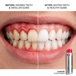😁 Teeth whitening, gum swelling and pain relief, gum repair, halitosis treatment, mouthwash for removing foreign objects, whitening mouthwash
