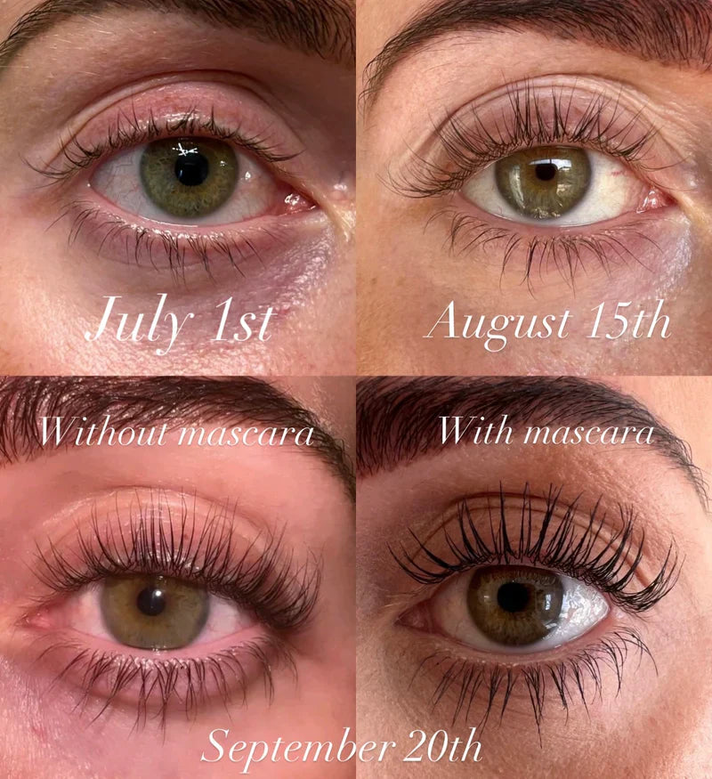 LashGlow – Natural Eyelash Growth Serum