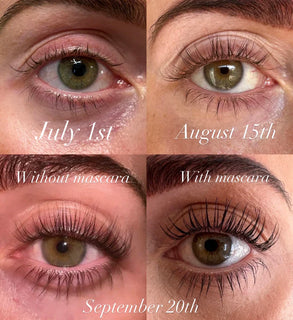LashGlow – Natural Eyelash Growth Serum