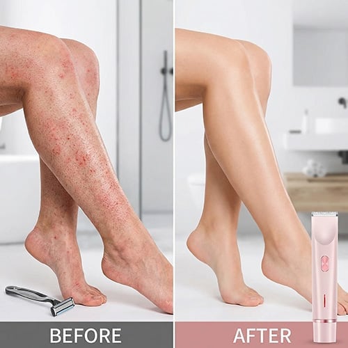 Gentle whitening