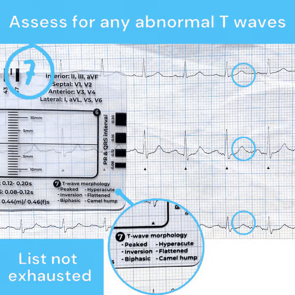 MediTrack – Professional ECG Assessment Pocket Guide