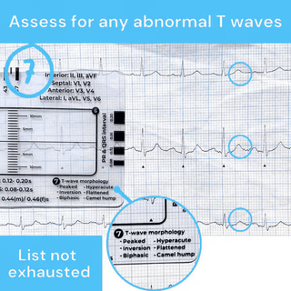 MediTrack – Professional ECG Assessment Pocket Guide