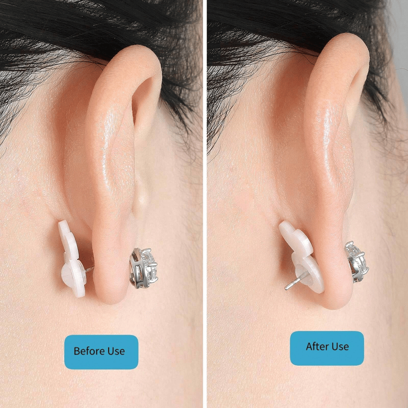 LiftGleam – Effortless Earring Support