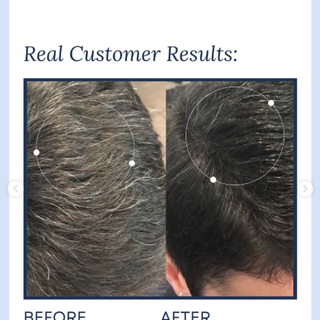 GrowHair – Proskire Anti-Grey Hair Serum