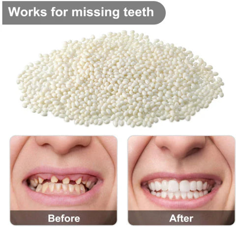 EnamelGuard – Cavity Healing Tooth Armor