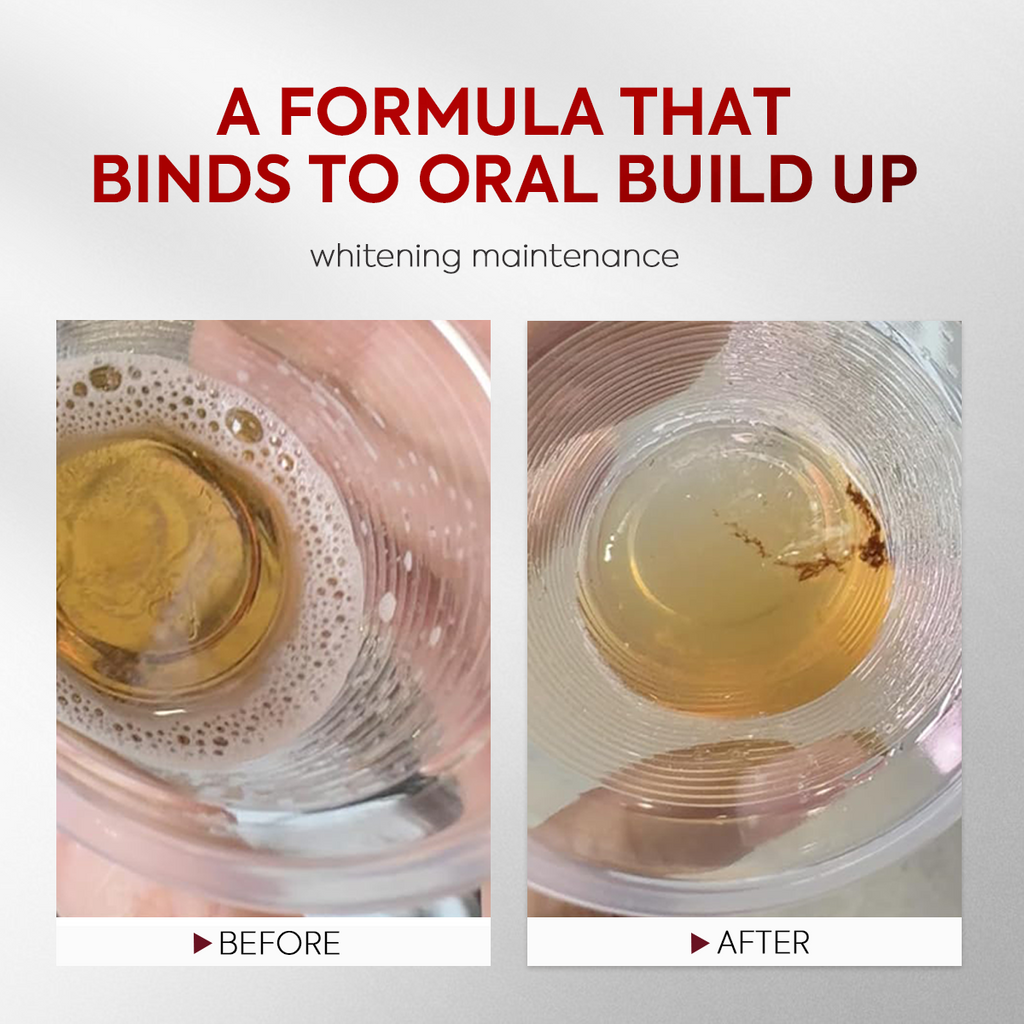 FreshMira – Stain-Lifting Whitening Mouthwash